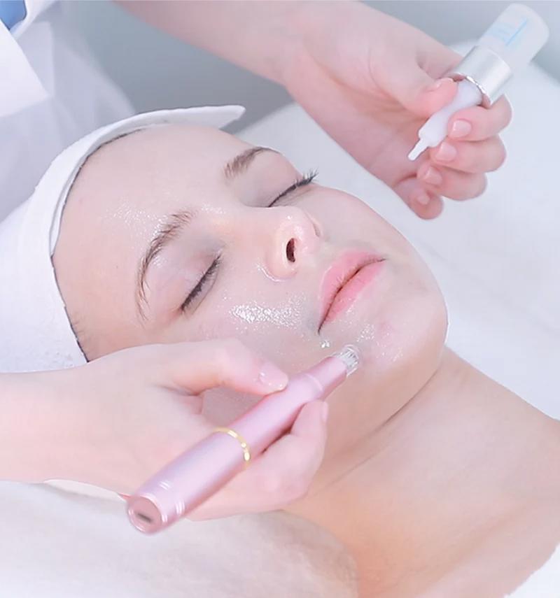 Oxygen Facials with Microchanneling