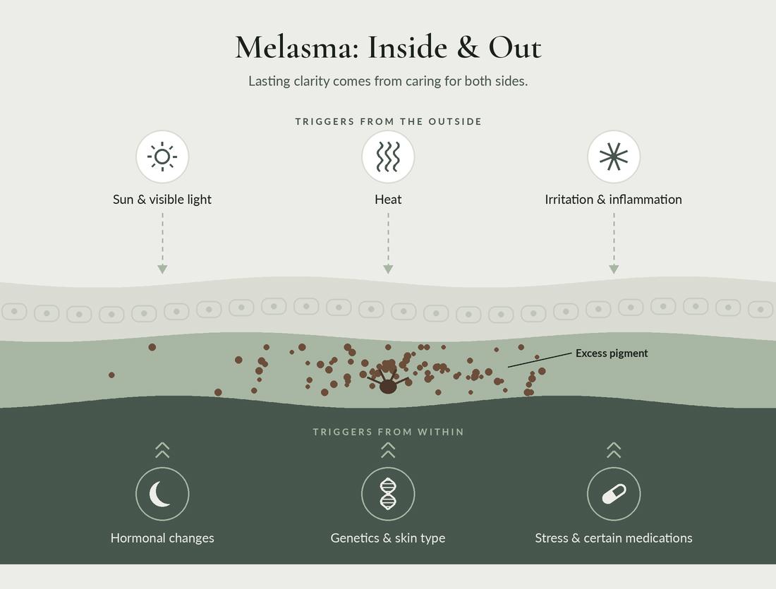 Melasma inside and out: triggers from the outside such as sun, heat and irritation, and from within such as hormones, genetics, stress and certain medications.